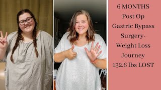 6 Month Update | Gastric Bypass | Post Op | Weight Loss Journey
