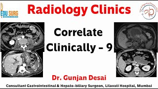 Master abdominal imaging on CT scan - Correlate clinically - 9