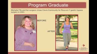 Bariatric Surgery Introduction