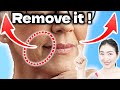 Night Power Routine to Remove Nasolabial Folds and Sagging & Wrinkles Around Mouth