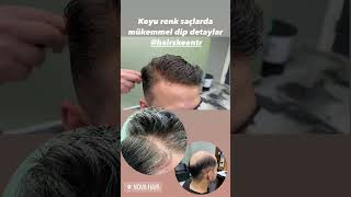 Protez saç mı, Folligraft mı? En doğal saçlar için Nova Hair #protezsaç #folligraft #novahair