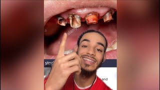 Fluoride Toothpaste Is A Scam