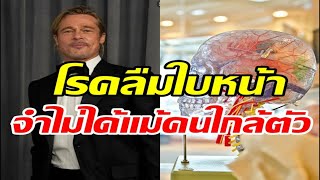 รู้จักโรคลืมใบหน้า อาการป่วยที่ทำแบรด พิตต์ ไม่อยากออกจากบ้าน