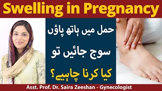 Swelling in Pregnancy | How To Reduce Swelling | Pregnancy Mai Jism par Sojan ki Wajohat