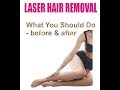 LASER Treatment - On Skin or Hair Removal: Some Precautions: Dr Neeta Ratti VITAL CLINIC