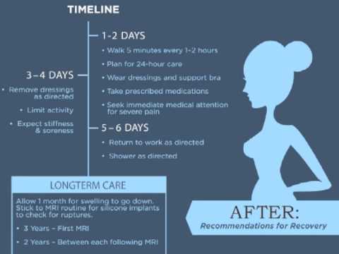 Breast Augmentation: Steps For A Safe Surgery & Rapid Recovery - YouTube