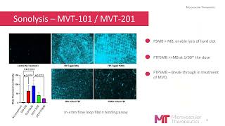 Emmanuelle Meuillet: Novel Phase Shift Microbubbles for the Treatment of Vascular Clots