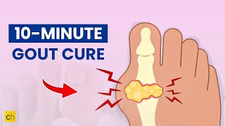 10-Minute Gout Cure for Quick Relief and Recovery - Credihealth