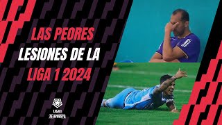 LOS QUEREMOS VER VOLVER MÁS FUERTES: conoce las peores lesiones de la Liga 1 Te Apuesto 2024