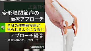 膝①膝OA5アプローチポイントの違いを知ろう