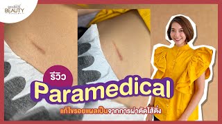 เทคนิค Paramedical แก้ไขรอยแผลเป็นจากการผ่าตัดไส้ติ่ง | Bangkok Beauty Academy