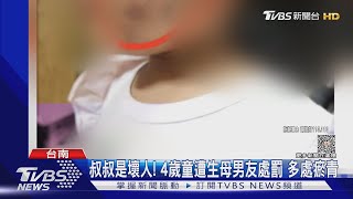 叔叔是壞人! 4歲童遭生母男友處罰多處瘀青 生父怒告｜TVBS新聞 @TVBSNEWS01