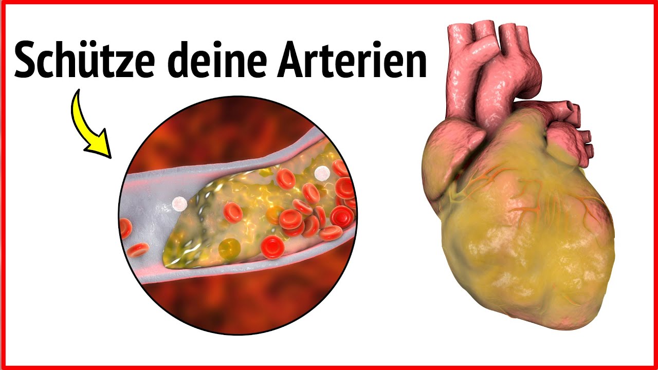 Arterien Reinigen: Maximale Wirkung Durch Diese 4 Lebensmittel - YouTube