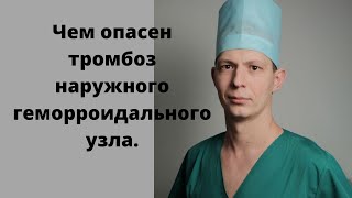 Чем опасен тромбоз наружного геморроидального узла. Нужна ли операция.