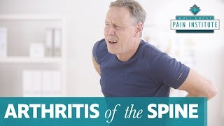 Treatment for Arthritis of the Spine