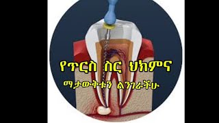 የጥርስ ስርህክምና ማታውቁትን ልንገራቹ