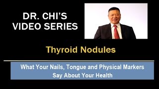 Dr. Chi's Fingernail and Tongue Analysis - Thyroid Nodules