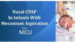 Today new born baby meconium aspiration care \u0026 treatment on cpap in Nicu 🚼💉👨‍⚕️🏥