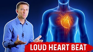 Why is Your Heart Pounding so Loud? – Dr. Berg on Heart Palpitations