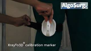 XrayTo3D Calibration Marker Protocol