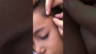 Find and catch a lot of lice on the cute girl's head