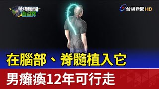 在腦部、脊髓植入它 男癱瘓12年可行走