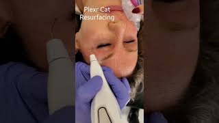 PLEXR PLUS CAT RESURFACING TREATMENT