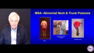 Introduction to MSA: Clinical Features, Diagnosis and Pathology - Dr. Anthony Lang (Part 2)