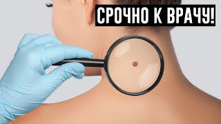 ЕСЛИ У ВАС ЕСТЬ ЭТИ СИМПТОМЫ, СРОЧНО ОБРАТИТЕСЬ К ОНКОЛОГУ!