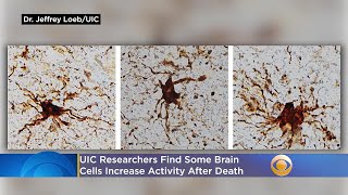 'Zombie Genes'? UIC Researchers Find Some Brain Cells Increase Activity After Death