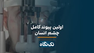 تک‌نگاه - اولین پیوند کامل چشم‌ انسان