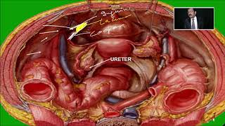 Laparoscopic Anatomy of Pelvis by Dr R K Mishra