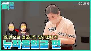 [끌리뷰] 🤲두손모아 광대박살! 1회만으로 얼굴라인 달라진다! | 뉴작은얼굴