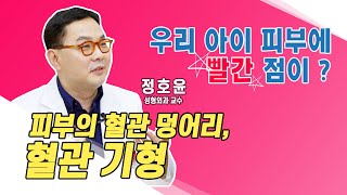 [닥터K] 🔴🔵혈관기형? 우리아이👶 피부에 이건 뭔가요? l 성형외과 정호윤 교수