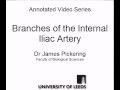 Branches of Internal Iliac Artery