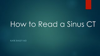 How to read a Sinus CT