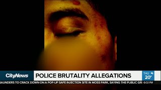 TPS again fails to notify SIU about alleged police brutality