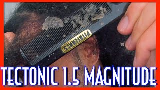 TECTONIC FLAKES MONTAGE (MAGNITUDE 1.5) | DANDRUFF ON SCALP | SEBORRHEIC DERMATITIS | PitaFlakes