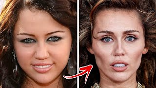 Celebrities Who Regret Their BOTCHED Plastic Surgeries