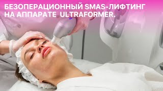 Безоперационный SMAS-лифтинг на аппарате ULTRAFORMER. Ответы косметолога на популярные вопросы.