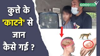 Ghaziabad 14 Year Old Boy Dog Bite Reason, Rabies Symptoms In Human Explained | Good Life