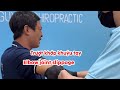 Trượt khớp khuỷu tay #elbowdislocation #Elbowjointslippage #truotkhopkhuyutay #tratkhopkhuyutay