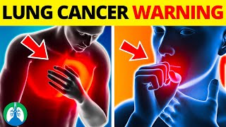 Top 10 Early Warning Signs of Lung Cancer to Look For ⚠️