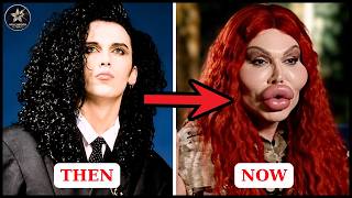 Top 7 Celebrity Plastic Surgery Transformations That Shocked The World | Then and Now 2026