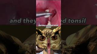 STINKY WHITE BALLS IN YOUR MOUTH |  | Medical Reaction Vids #shorts