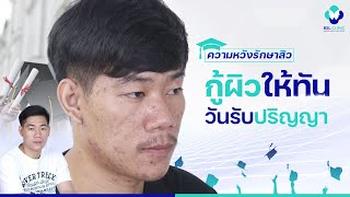 รักษาสิว | EP.142 | สิวอักเสบและรูขุมขนกว้าง อย่าปล่อยให้เป็นปัญหาในวันพิเศษของคุณ | BSL Clinic