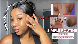 HOW TO GET RID OF BODY HYPERPIGMENTATION | Using only 3 products | A simple routine for Even skin✅