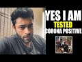 MEGA FAMILY HERO #VARUNTEJ TESTED POSITIVE FOR #COVID-19 | Telugu Tonic