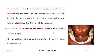 CM Dental Bytes - 'Enamel Hypoplasia\