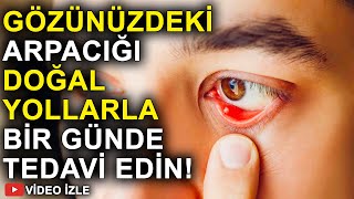 Arpacık Nasıl Hızlıca Tedavi Edilir? İt Dirseği ya da Arpacık İçin Doğal Çareler!